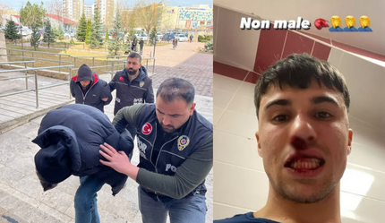 Sivasspor - Fiorentina maçı sonrası 2 taraftar tutuklandı! Sahaya girip İtalyan futbolcuyu yumruklamıştı - spor