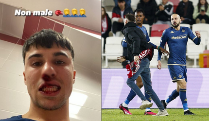 Sivasspor - Fiorentina maçında dehşet anlar! Sahaya giren taraftar futbolcunun burnunu kırdı - spor