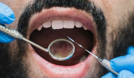 Dişçiye gitmek orucu bozar mı? Dişe iğne yaptırmak orucu bozar mı? - haberler