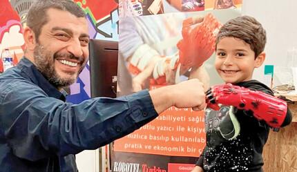 Robot eller çocukları hayata bağlıyor: Umuda ‘el veriyorlar’ - saglik