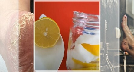 Topuk çatlaklarını yok eden 6 yöntem! Anında pamuk gibi olmasını sağlıyor - yasam