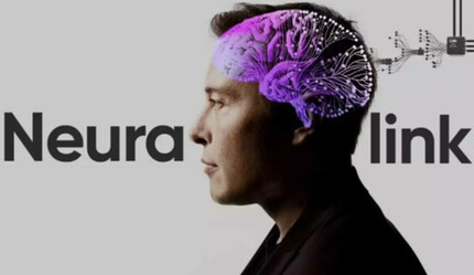Hayvanlar deneylerde ölmüştü... Musk'ın beyin çipi insan testleri için onay aldı - gundem