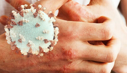 Estetik ameliyatlarla bağlantılı mantar salgını ölümlere yol açtı - saglik