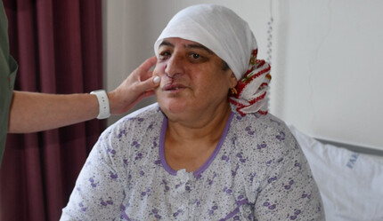 Yüzündeki şişliği fark edip doktora koştu… 19 yıl sonra acı gerçekle tekrar yüzleşti - saglik