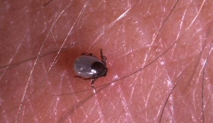 Uzman uyarısı: Kenenin üzerine çamaşır suyu, benzin, gaz yağı dökmeyin - gundem