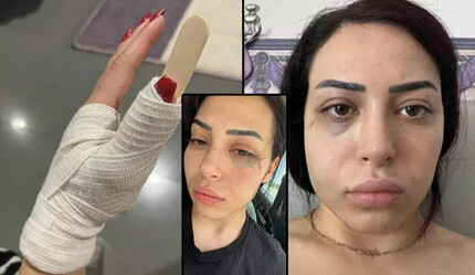GKRY'de Türk kızına taciz ve darp! 2 Rum tutuklandı - gundem
