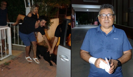Tasmasız doberman parkta dehşet saçtı: Adamı hastanelik etti - gundem