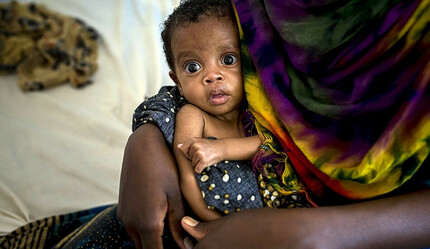 Nijerya'da difteriden ölenlerin sayısı 83'e yükseldi - dunya