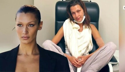 Hasta halleri sevenlerini yıkmıştı! Aylar sonra sete çıkan Bella Hadid’in kıpır kıpır halleri dikkat çekti - magazin