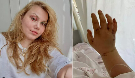 Eşi tarafından 32 yerinden bıçaklanan ünlü Youtuber'dan ilk mesaj!