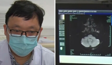 Yabancı biri görünüşüne bakarak teşhis koydu, hayatı kurtuldu: Beyninde ölümcül tümör çıktı - saglik