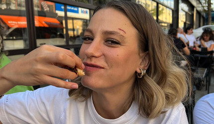 Serenay Sarıkaya’nın kaşındaki yara korkuttu, açıklaması gecikmedi - medya