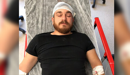 Tartıştığı sürücüye çekiçle saldırdı - gundem