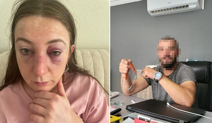 Eski erkek arkadaşı tarafından darp edilen kadın: Ölüm tehditleri alıyorum - gundem