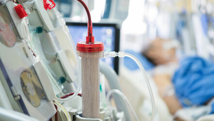 Sepsis her 3 saniyede 1 can kaybına neden oluyor - saglik