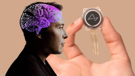 Elon Musk'ın beyin çipi projesi onaylandı: İnsan deneyleri başlıyor - teknoloji