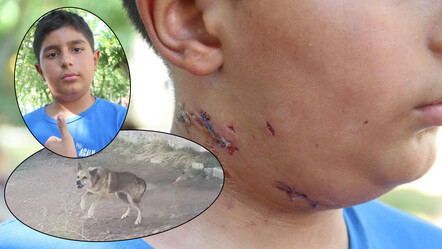 Köpeği sevmek istedi, dehşeti yaşadı! 10 yaşındaki çocuğun boynuna 6 dikiş atıldı: 'Şah damarını ısırabilirdi' - gundem