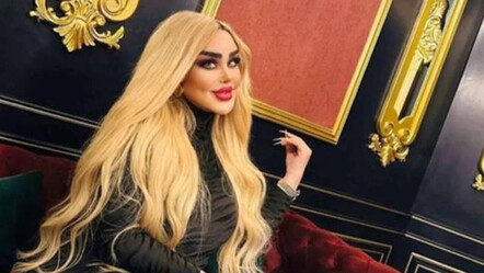 Barbie'ye benzemek istedi, onlarca ameliyat geçirdi: Bir türlü memnun olamayan kadın 44'üncü operasyona hazırlanıyor - saglik