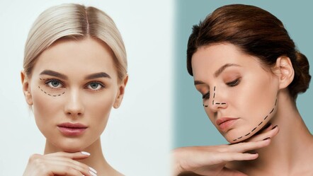 Hanımlar dikkat! Keskin yüz hatlarına estetiksiz sahip olmak aslında çok kolay… - saglik
