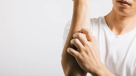 Türkiye genelinde vakalar yüzde 30 arttı! Uyuz hastalığı nedir? Belirtileri neler, nasıl bulaşıyor? - saglik