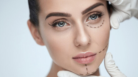 Merdiven altı estetik rezidanslara taşındı - saglik