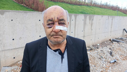 Taksici yaşadığı dehşet anları anlattı! 'Arabanın içerisinde vurmaya başladı' - gundem