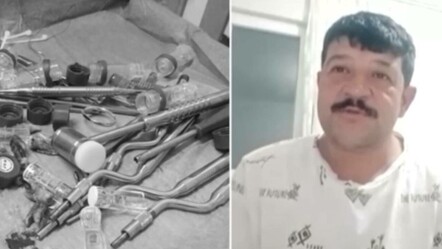 Sahte doktor hem sağlığından hem parasından etti! 40 dakikada dişsiz kaldı - gundem