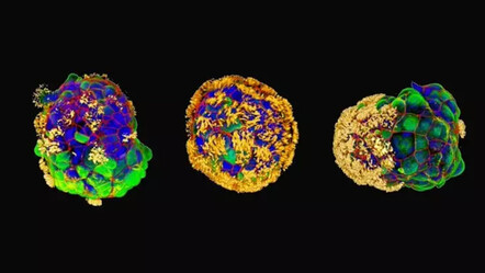 İnsan hücrelerinden canlı mini robot geliştirildi! Yaraları ve hasarlı dokuları iyileştirecek - teknoloji