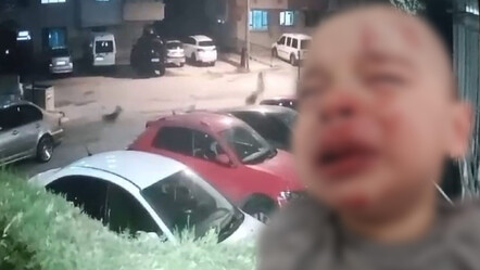 Ankara'da başıboş köpek terörü! Kızını korumaya çalıştı, kucağındaki bebek dehşeti yaşadı - gundem