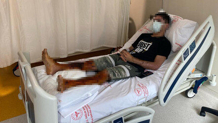 Herkesin evinde var! Bomba gibi patladı, vücudunun yüzde 35'i yandı - gundem