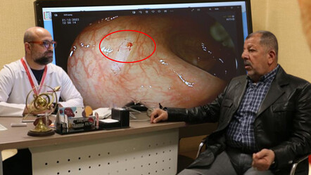 Yutkunma problemiyle gitti, gerçeği hastanede öğrendi! 3 kişiden 1’i risk altında… - saglik