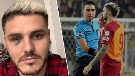 Futbolun unutulduğu derbide tartışılan tek konu: Direk değil kafa - spor