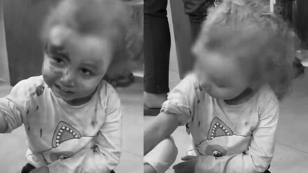 İsrail vahşeti, kanlar içinde titreyen 3 yaşındaki minik İman'ın gözlerinden okundu - dunya