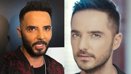 Estetik iddiasıyla gündeme gelen Gökhan Özen yüzündeki değişimin nedenini açıkladı - magazin