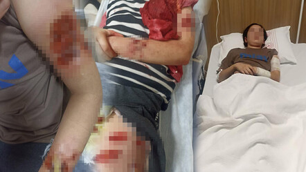 Şanlıurfa'da sokak köpeği dehşeti! 12 yaşındaki çocuğu parçaladı - gundem