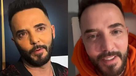 Son görüntüsü şaşırtan Gökhan Özen veryansın etti, estetik iddialarına filtresiz videoyla cevap verdi - magazin