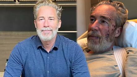 Dizi setinde kaza geçiren Sinan Albayrak’tan haber var! Yara bere içindeki yüzünü paylaştı - magazin