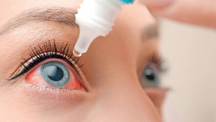 Soğuk havada, ilk gözler alarm veriyor! - saglik