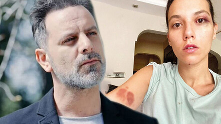 Ozan Güven ve Deniz Bulutsuz davasında adli tıp raporu hazır: Yaralanma basit ölçüde değil - magazin