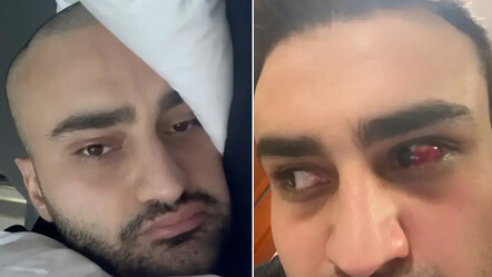 CZN Burak'ın son hali sevenlerini korkuttu, paylaşımına yorum yağdı - gundem