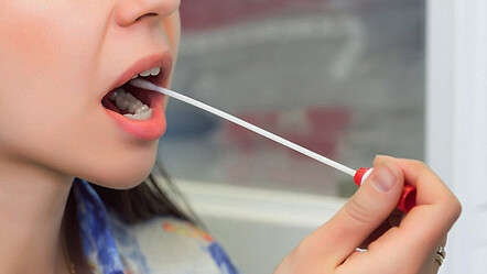 Ağızdaki sessiz tehlikeye dikkat! Tedavi edilmezse hastaneye yatırıyor - saglik