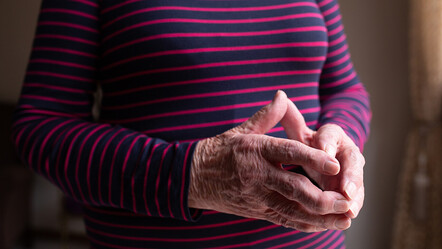 İltihaplı romatizması olanlar dikkat, doğru beslenme belirtileri hafifletiyor - saglik