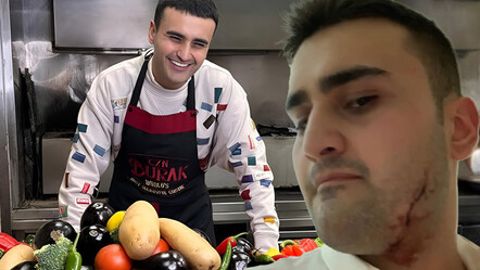 CZN Burak’ın vücudu kesikler içindeki hali korkutmuştu! Fotoğrafların iç yüzünü açıkladı - magazin