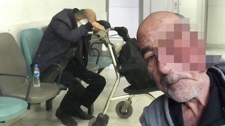 Nadir görülen hastalık hayatını alt üst etti: Gözü akıyor, suratı mum gibi eriyor... - saglik