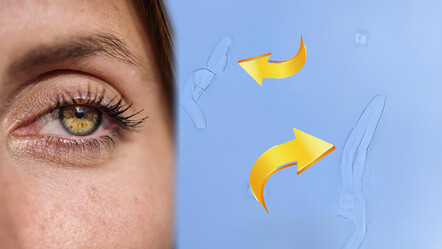 Gözde uçuşan sinekler neyin habercisi? Sayısında artış varsa…. - saglik