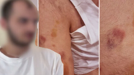 Otizmli öğrenciyi acımasızca darbeden eğitmene kelepçe! - egitim