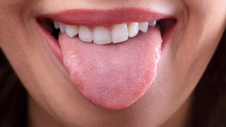 Renk değişikliklerine dikkat! Hastalıkları dilinizden teşhis edin - dunya