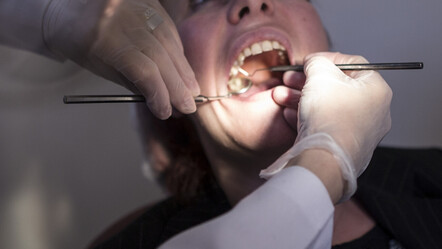 Sağlık değil, zehir saçıyor... Amalgam dolgu AB'de yasaklanıyor - saglik