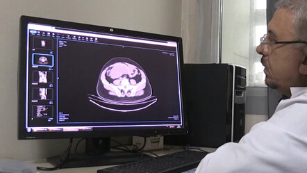 Kasık ağrısıyla hastaneye gitti, bağırsağından 3 kilogram tümör çıktı - saglik