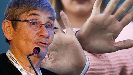 Canan Karatay ‘Bu başka pandemi’ deyip uyardı! Hemen avuç içlerinize bakın, işte en büyük belirtisi - saglik